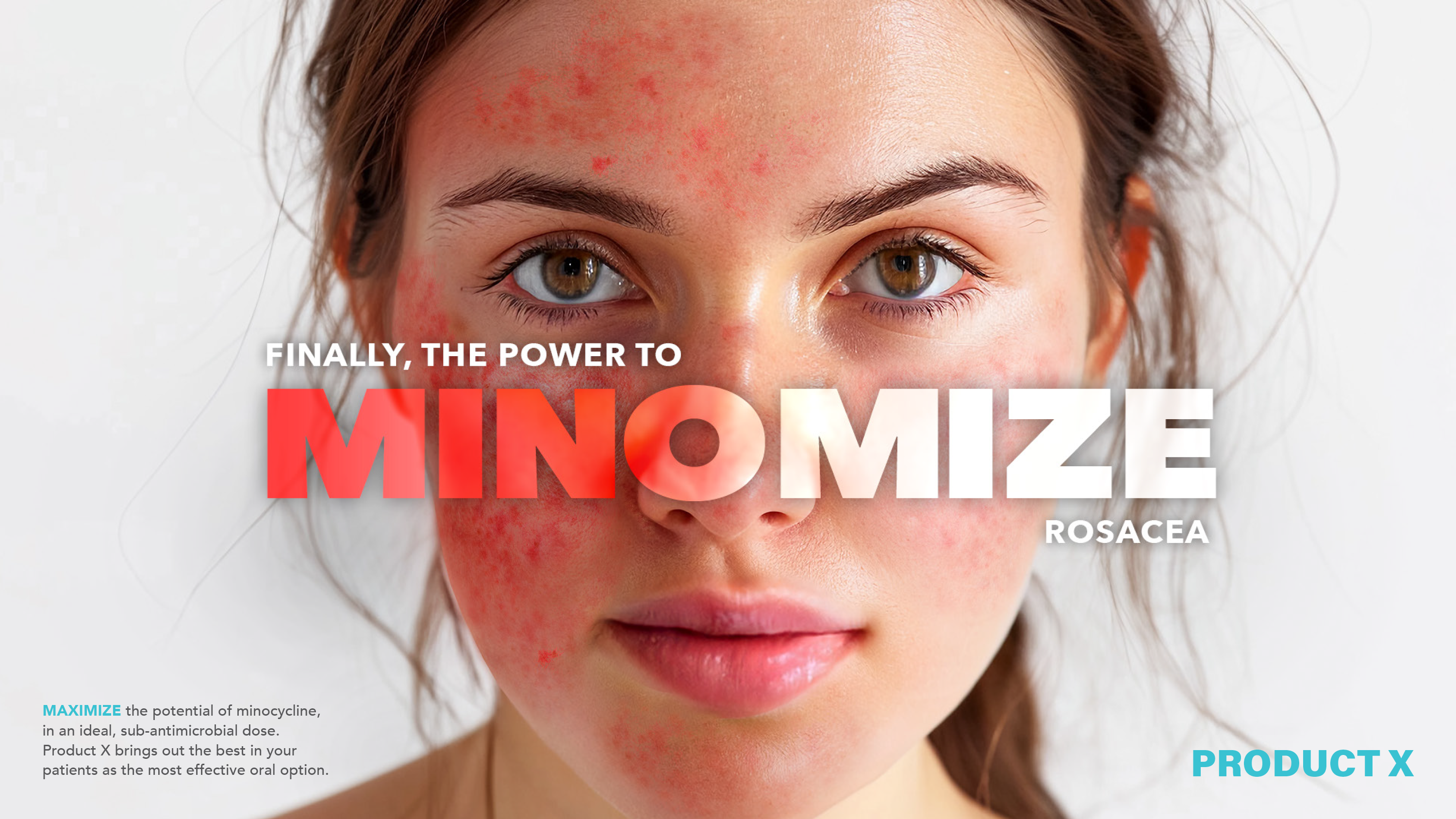 Tested Minomize concept in red