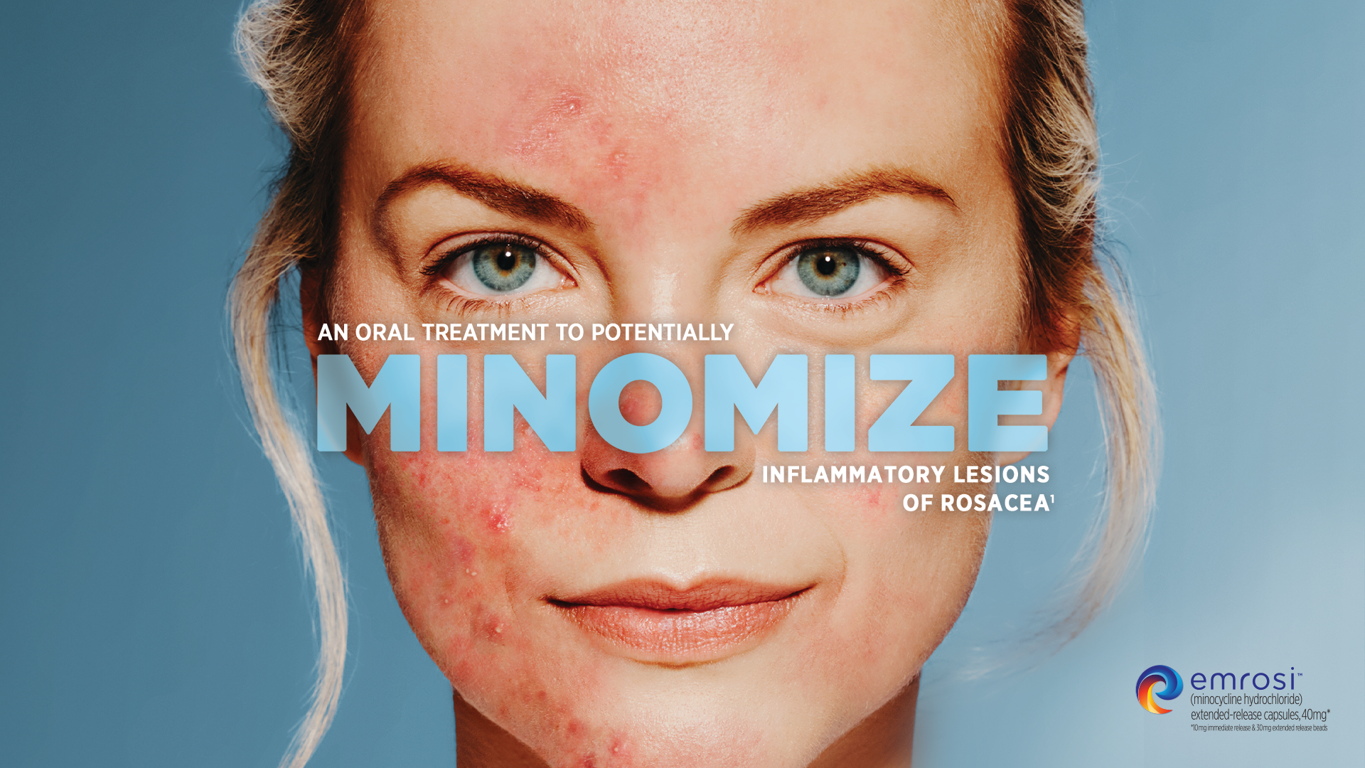 Emrosi Minomize launch campaign showing a patient before and after treatment